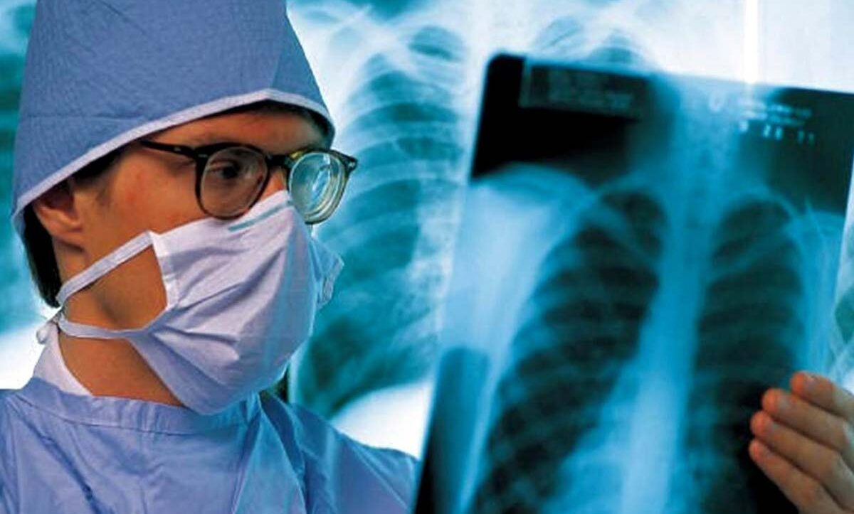 захворювання на туберкульоз