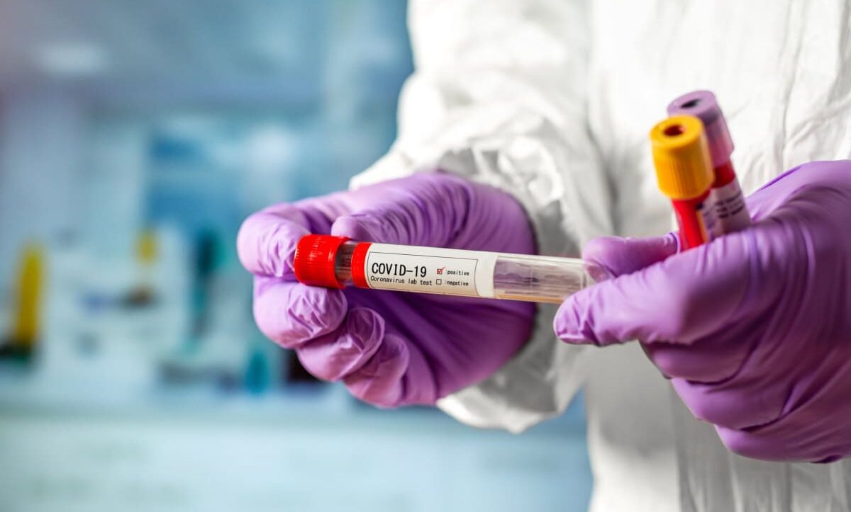 Covid-19 в Україні