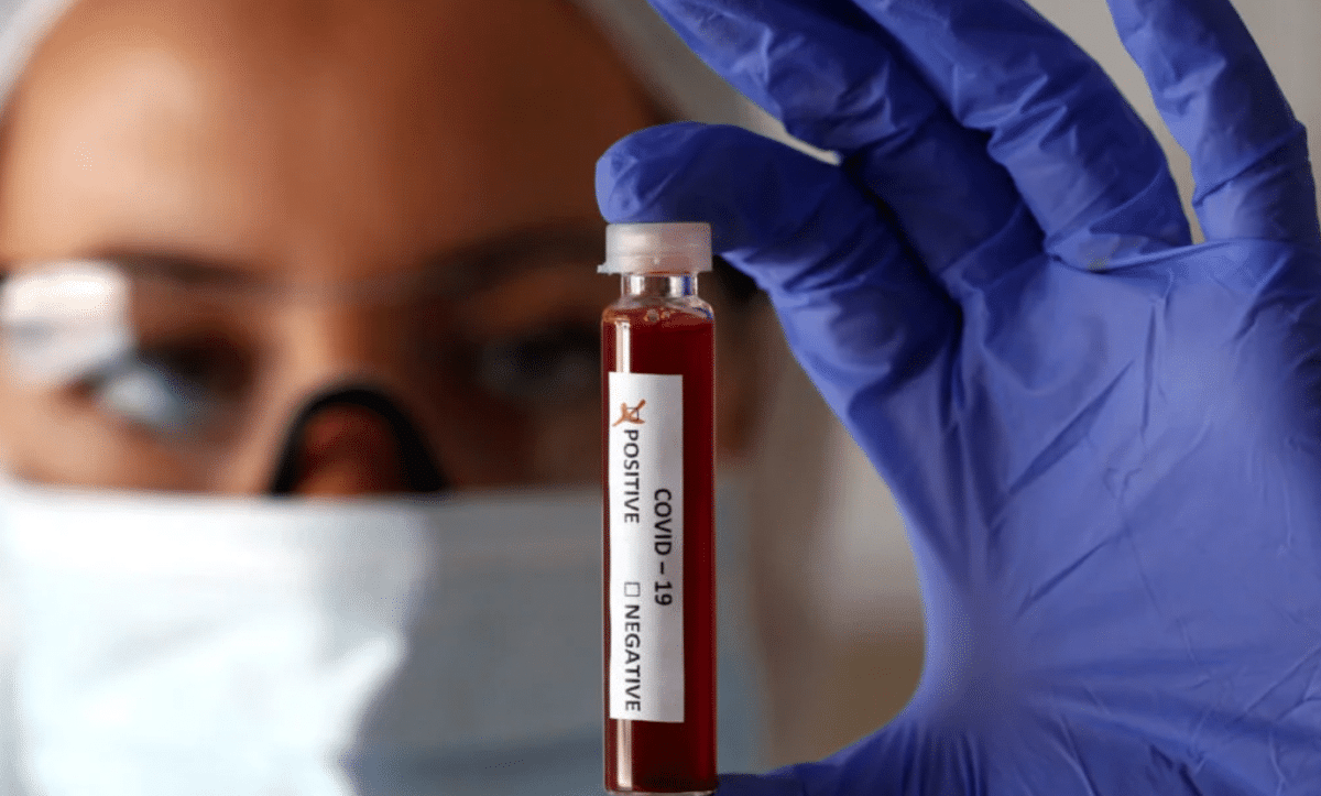 інфікування коронавірусом COVID-19