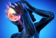 Всесвітній день боротьби з інсультом