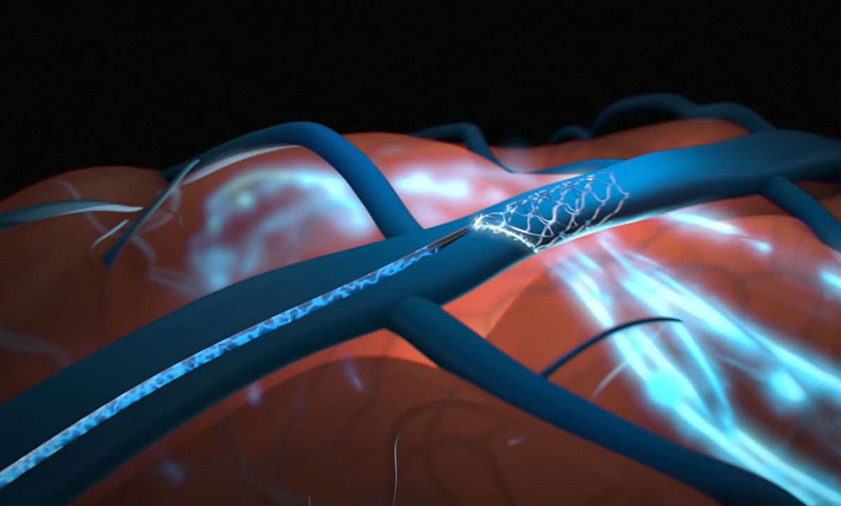 випробуваня мозкового чипа