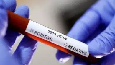 Covid-19 надзвичайна ситуація