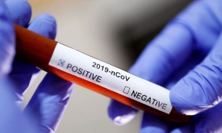 Covid-19 надзвичайна ситуація