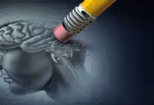 хвороба Альцгеймера