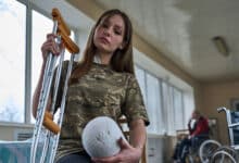 Ампутації війни в Україні