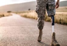 протезування українців