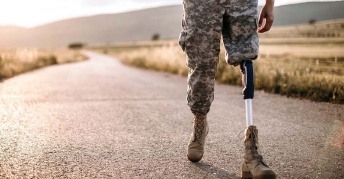 протезування українців