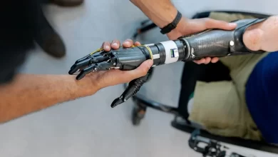 Протезування в Україні