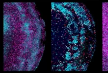 Мозковий органоїд з тканини плода