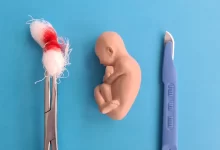 Аборти у 2023 році