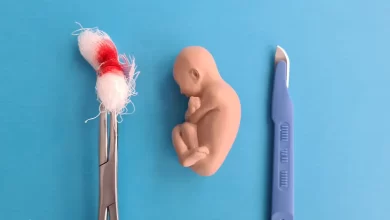 Аборти у 2023 році