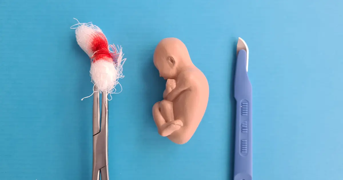 Аборти у 2023 році