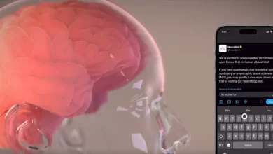 Neuralink імплант мозку