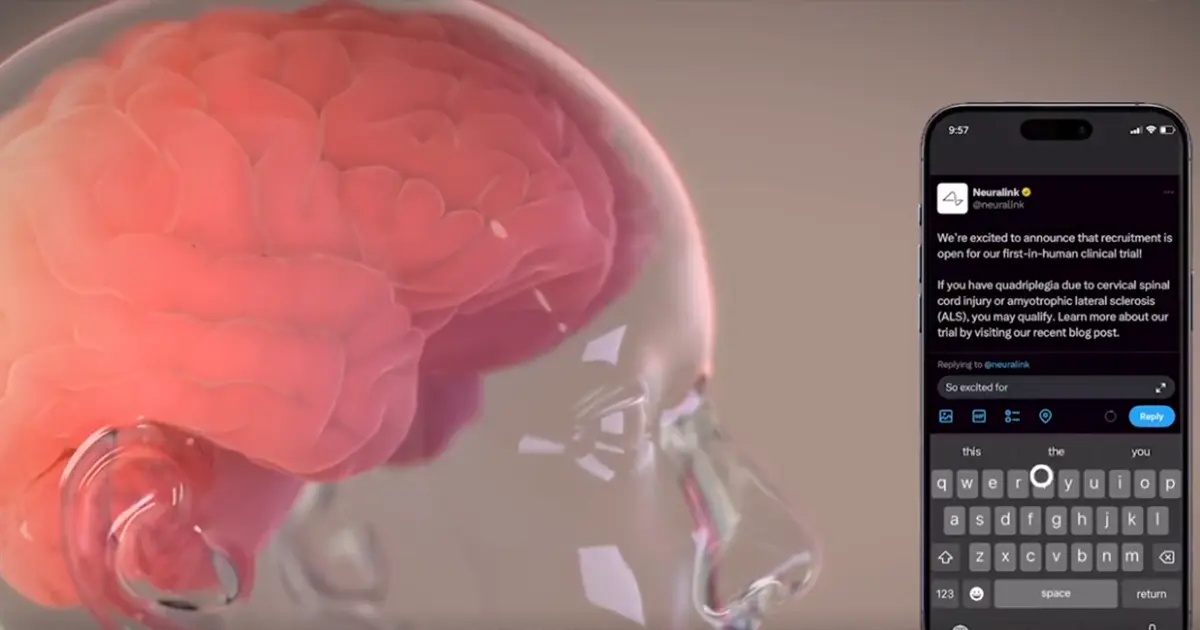 Neuralink імплант мозку