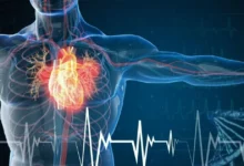 Серцево-судинні захворювання