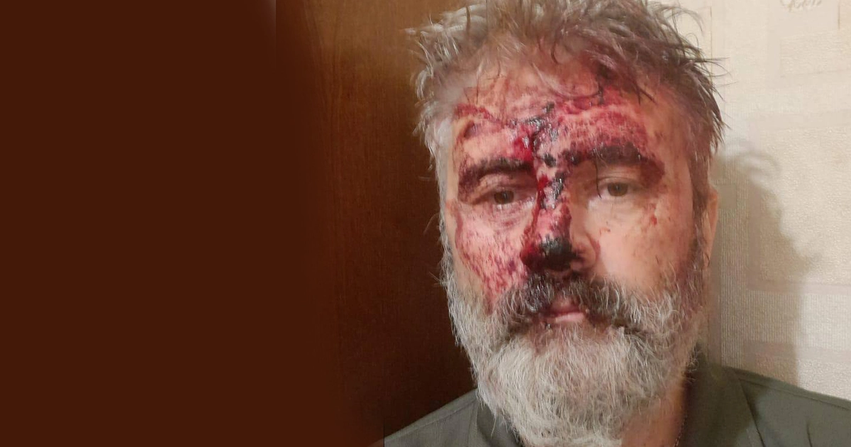 напад на митрополита Климента