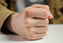 гнів і здоров'я