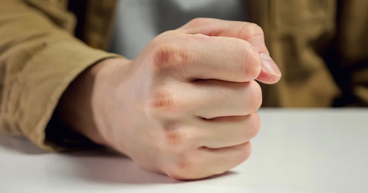 гнів і здоров'я