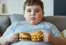 дитяче ожиріння в Україні