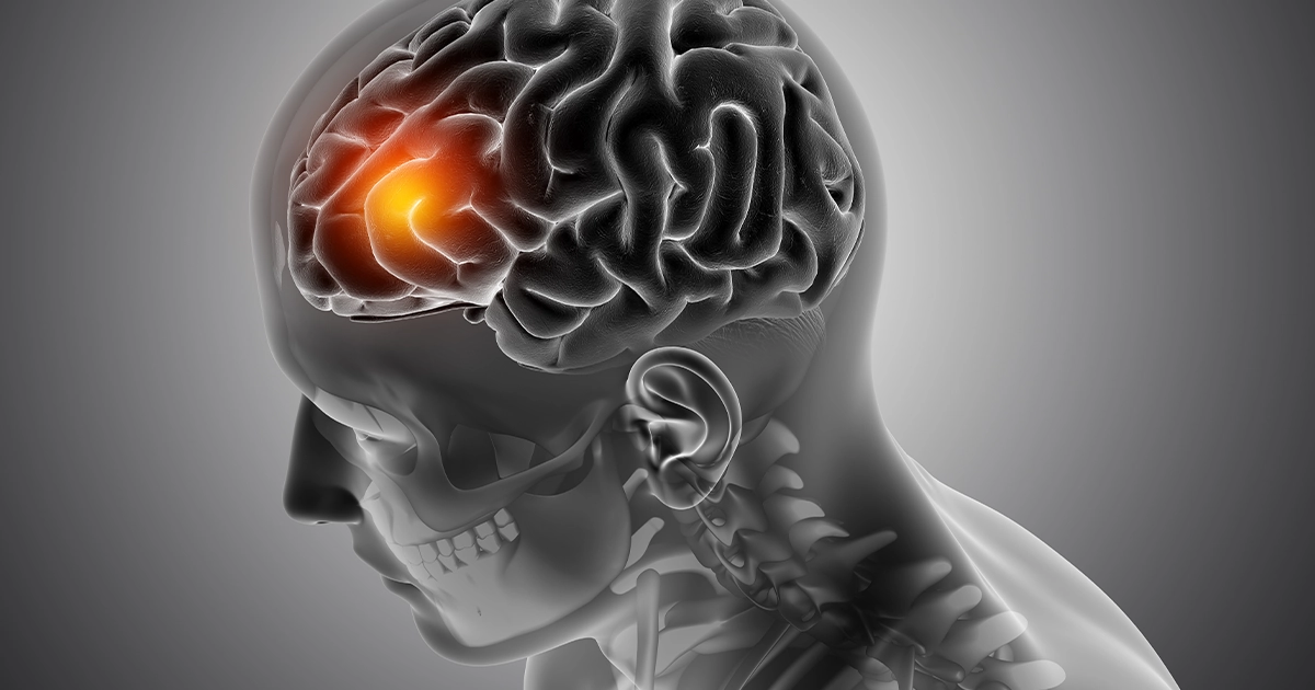 психічне здоров'я у світі