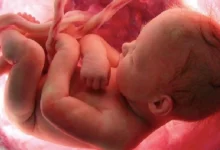 аборти у світі