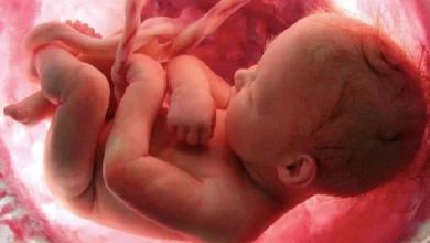 аборти у світі