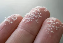 мікропластик і деменція