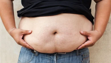 Дослідження показує стрімке зростання ожиріння у світі