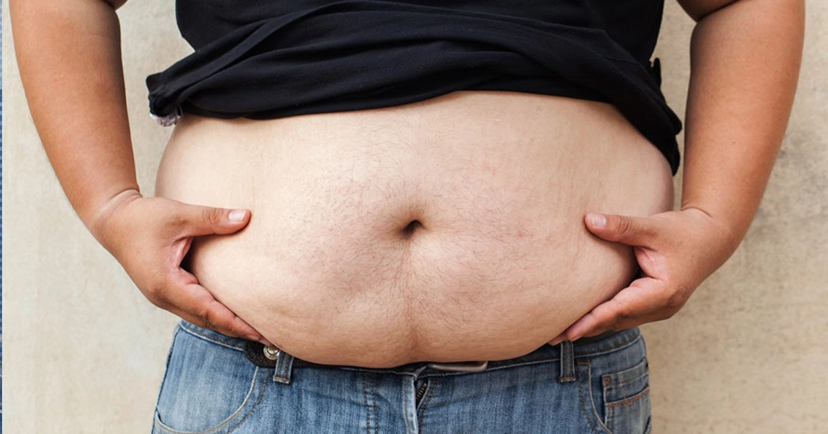Дослідження показує стрімке зростання ожиріння у світі