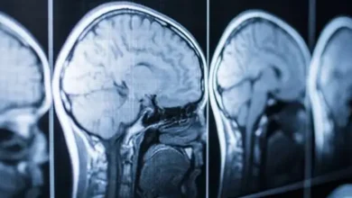 Мікропластик під мікроскопом — загроза для здоров’я людини