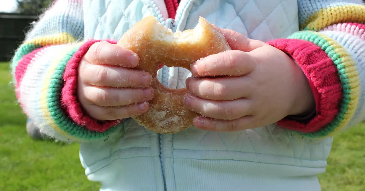 До 2040 року понад 220 млн дітей матимуть ожиріння — звіт