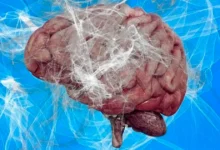 «Brain rot»: як надмірний час онлайн впливає на мозок